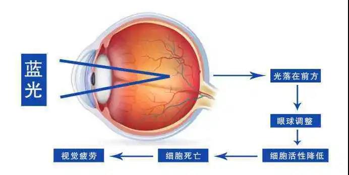 宅家1個(gè)月近視飆升200度？這個(gè)護(hù)眼方法別忽略！